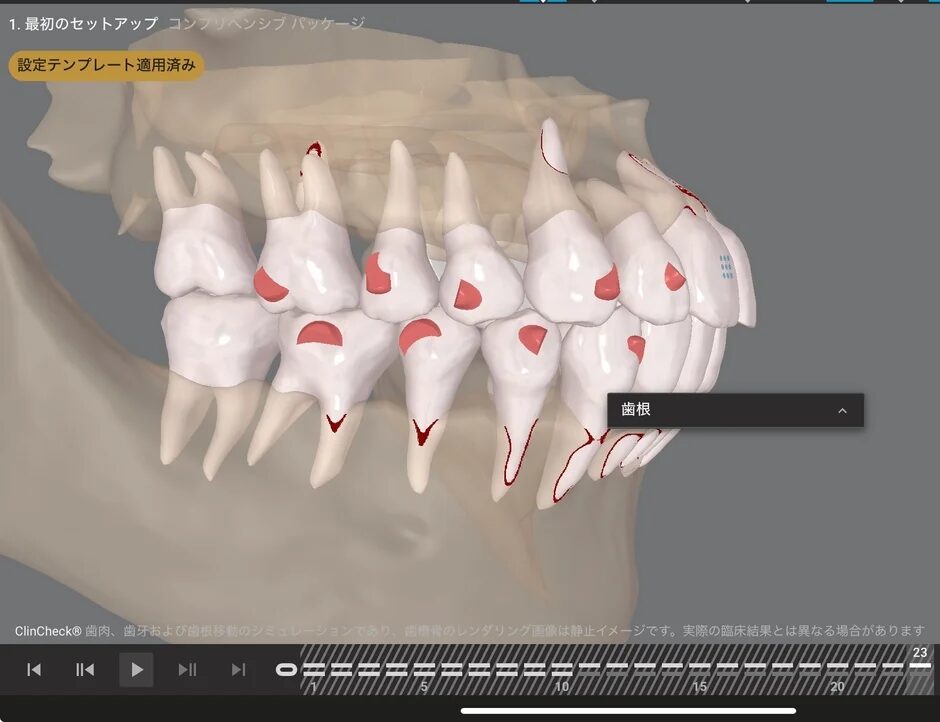 最初のセットアップ コンプリヘンシブ パッケージ