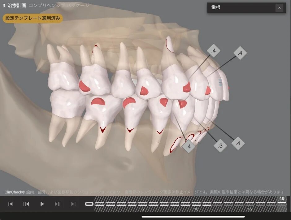 治療計画 コンプリヘンシブ パッケージ