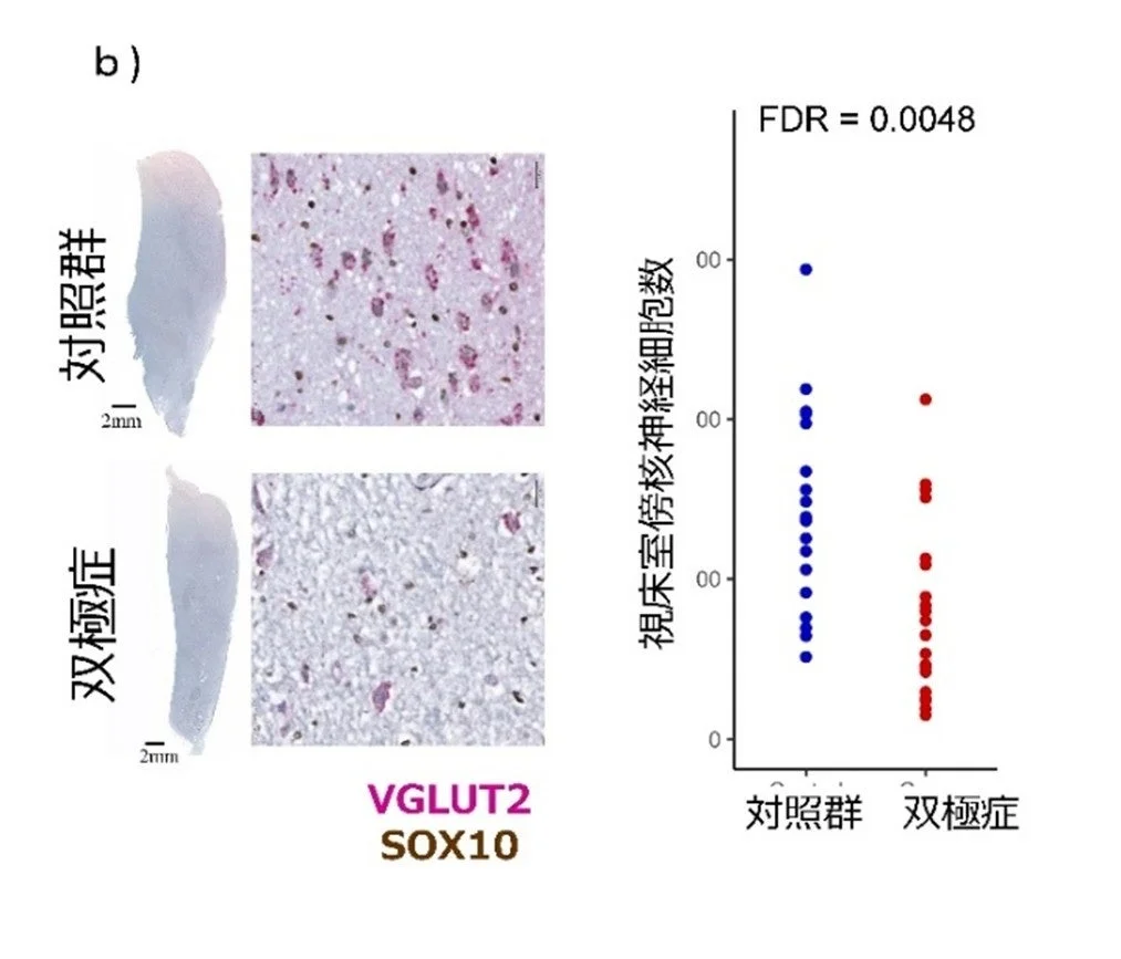 図2b 視床室傍核神経細胞数の減少