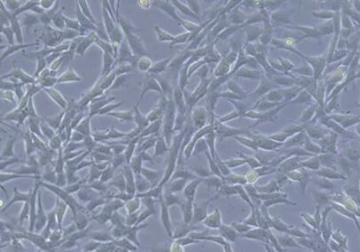 細胞、顕微鏡、生物学、組織培養、線維芽細胞、研究、実験、医療、科学