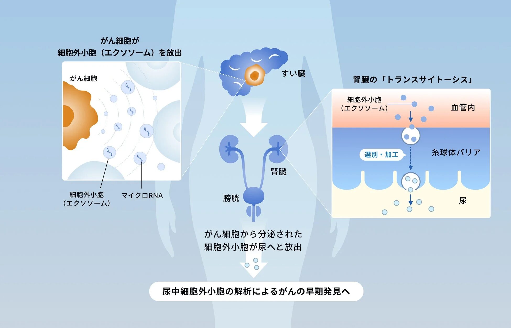がん細胞から分泌された細胞外小胞が尿へ放出されるメカニズム