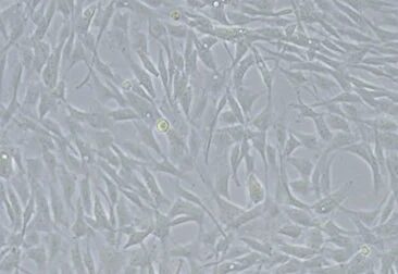 顕微鏡画像、細胞、細胞培養、生物学、培養細胞、繊維芽細胞、研究、形態学、科学、実験