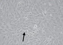 細胞、顕微鏡画像、細胞培養、生物学、実験、科学、形態、矢印