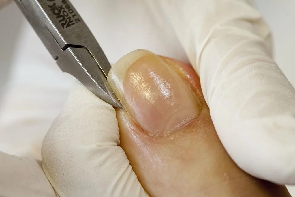 爪切り