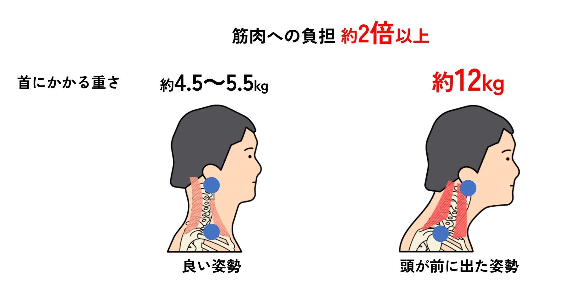 良い姿勢と頭が前に出た姿勢における首への負担と筋肉への負荷を比較した図