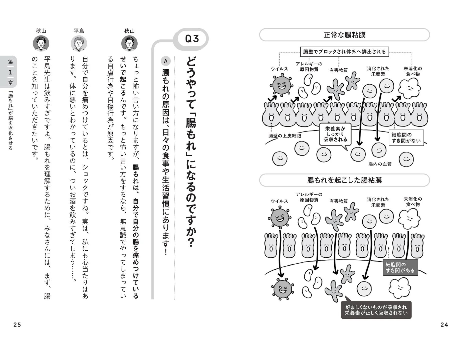 腸もれの原因とメカニズムを図と文章で解説。正常な腸粘膜と、腸壁の細胞間に隙間ができ有害物質が侵入し栄養吸収が阻害される腸もれの状態を比較。日々の食事や生活習慣が原因とされている。